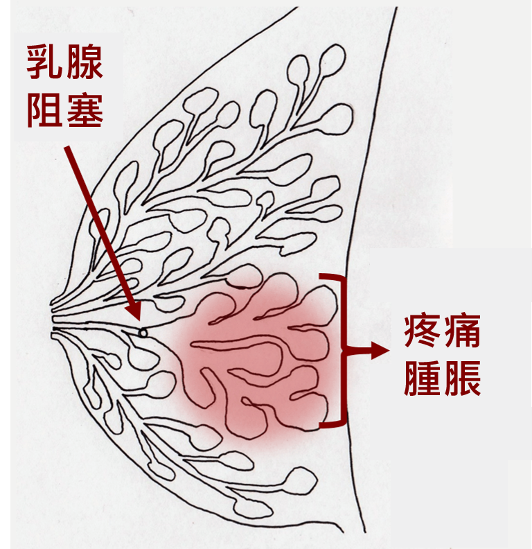 圖