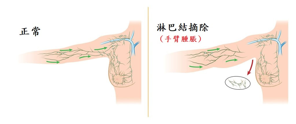 圖