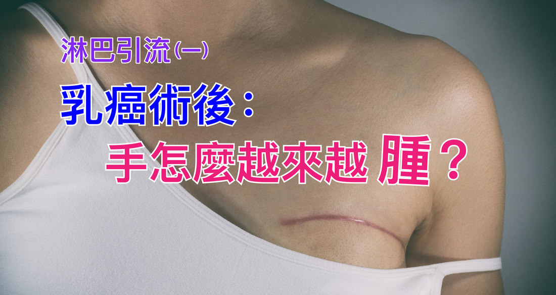 乳癌術後手越來越腫？台北大安淋巴引流徒手治療
