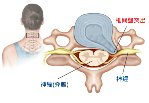 圖