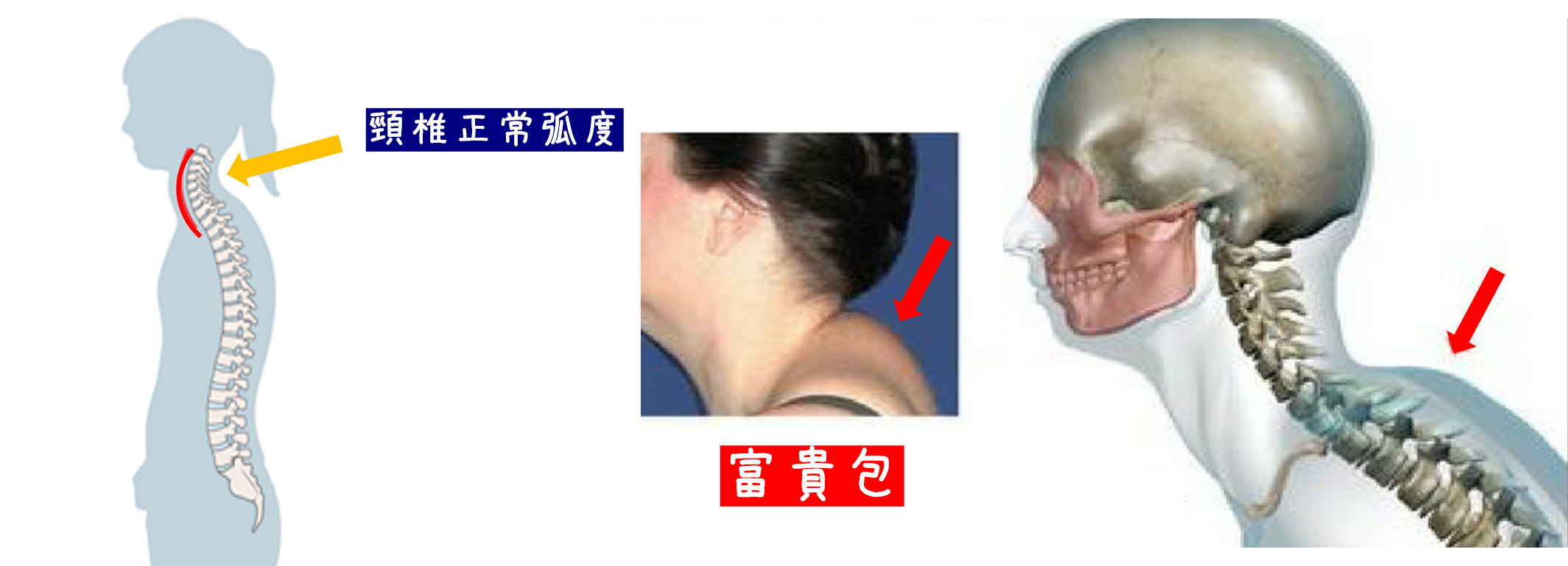 圖