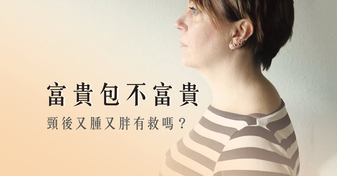 富貴包怎麼消？頸後腫一包的原因與改善