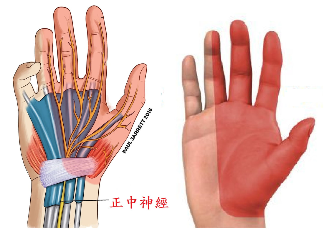 圖