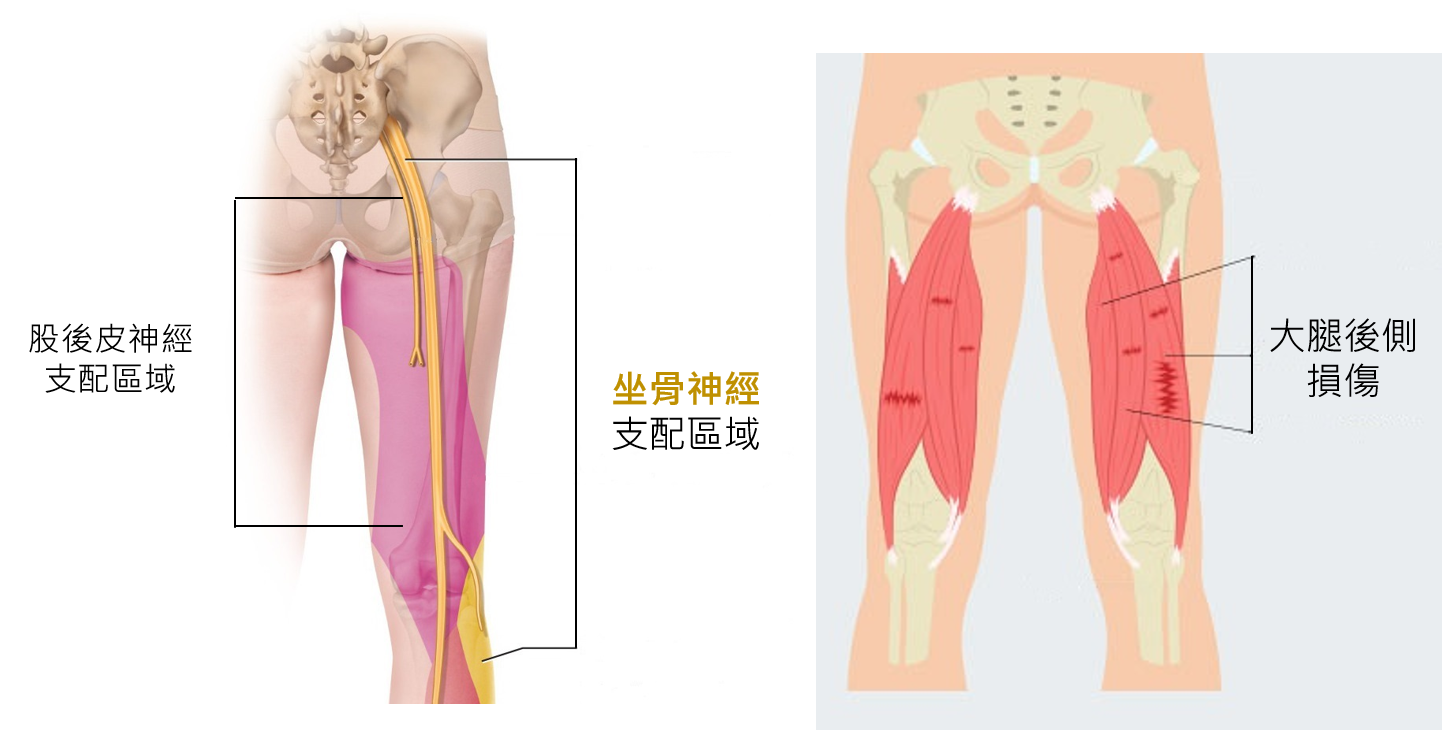 圖