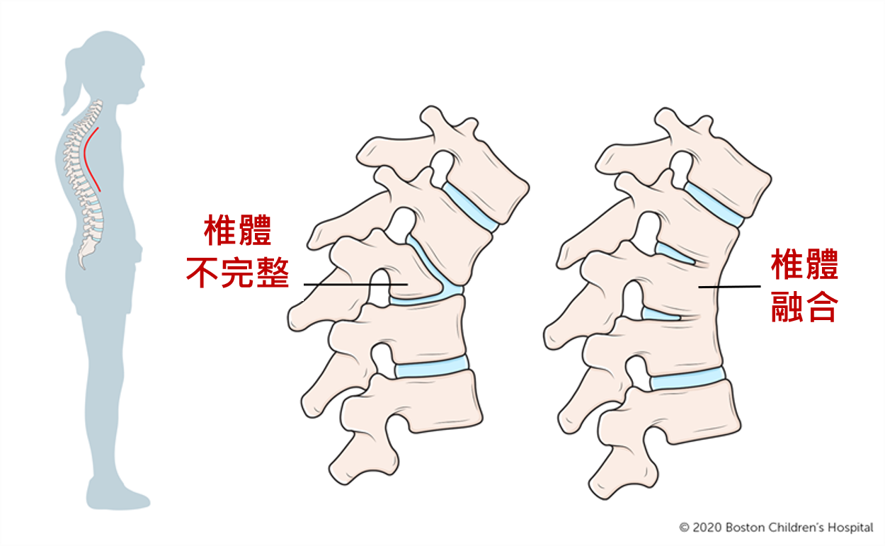 圖