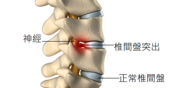 圖