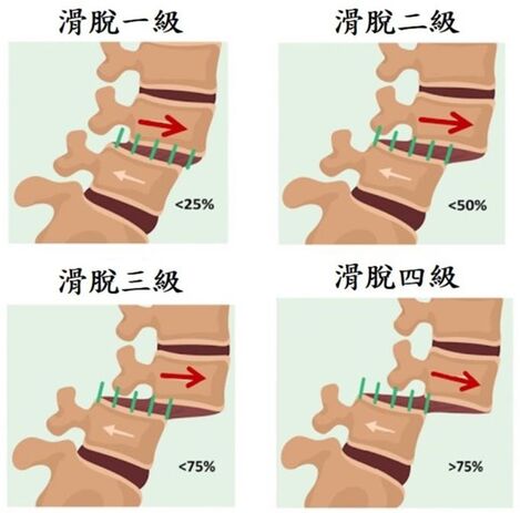 圖