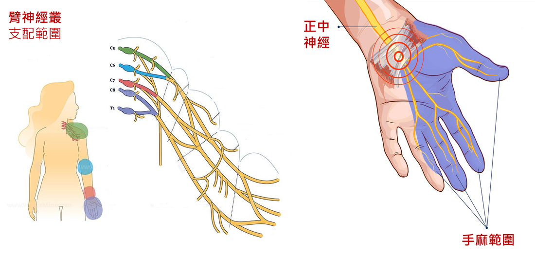 圖