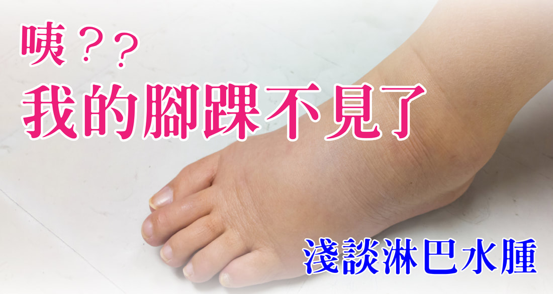 腳踝不見了？淋巴水腫怎麼辦？台北大安徒手治療