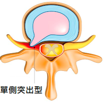 圖