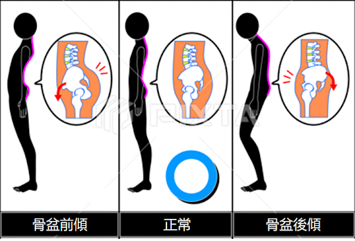 圖