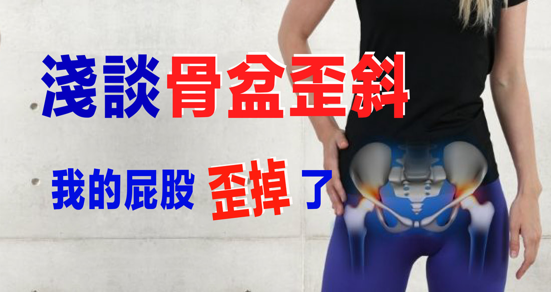 骨盆歪斜怎麼辦？腰痛長短腳的隱藏原因