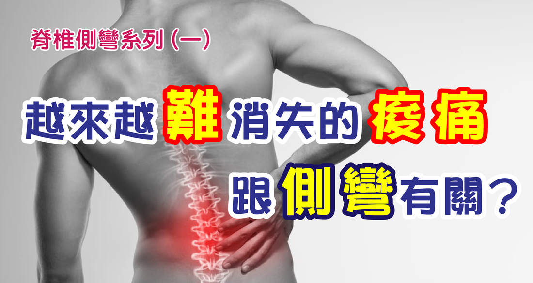 痠痛一直好不了？可能跟脊椎側彎有關