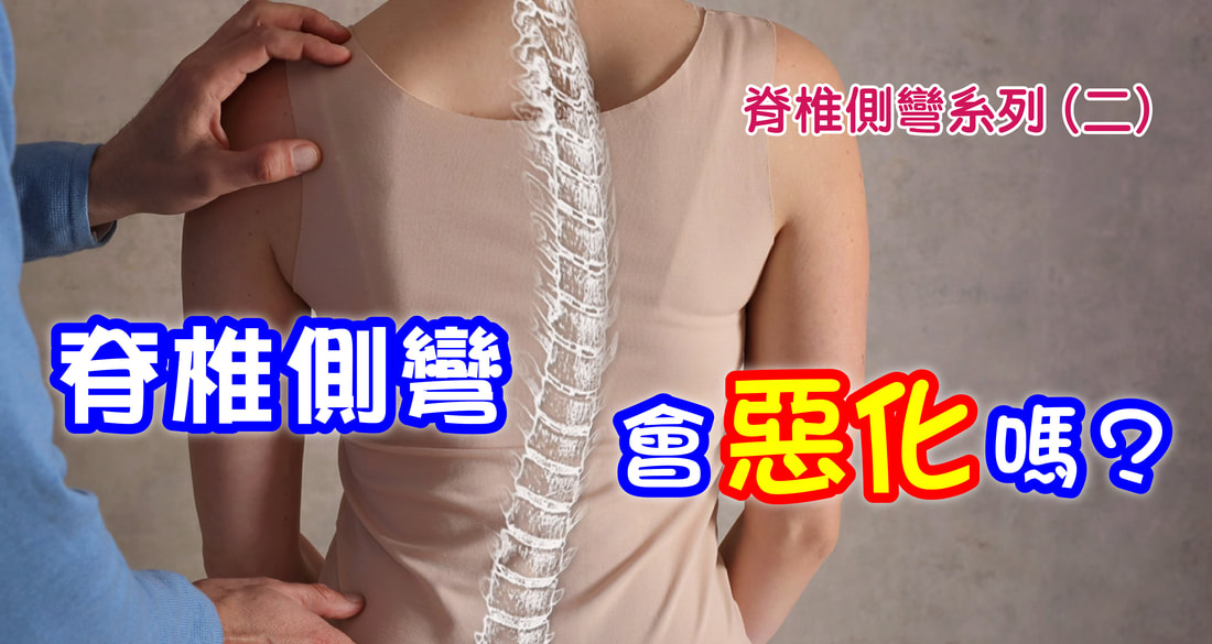 脊椎側彎會惡化嗎？角度與治療時機