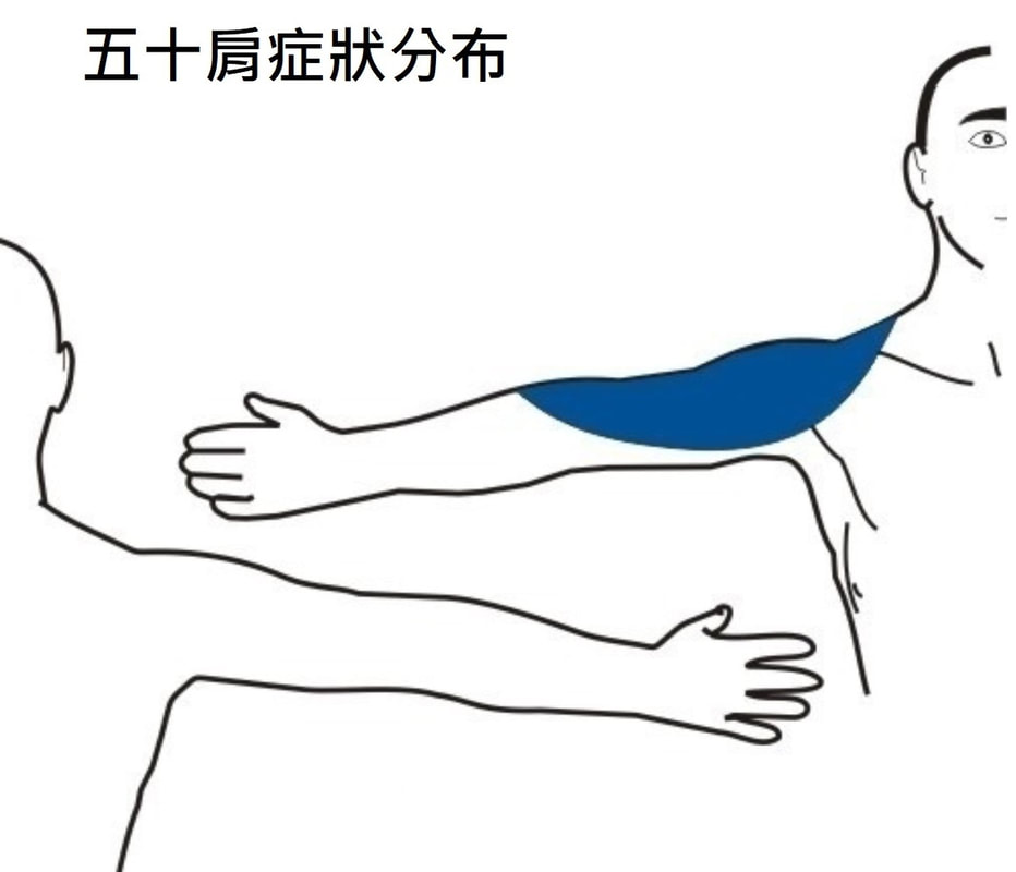 圖