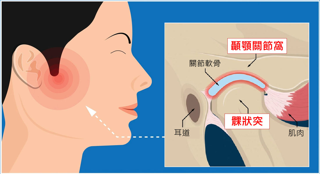 圖