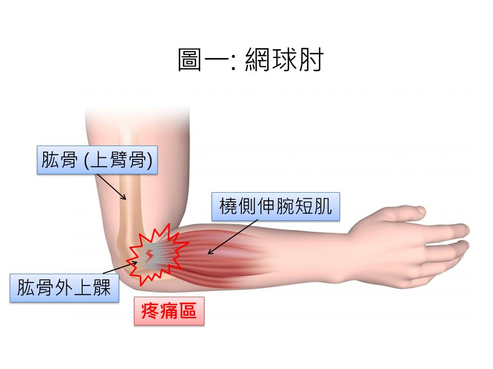 圖