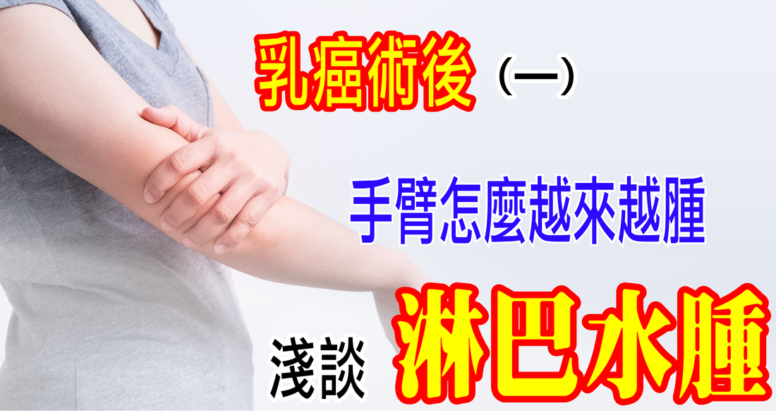 乳癌術後手臂越來越腫？台北大安淋巴引流徒手治療