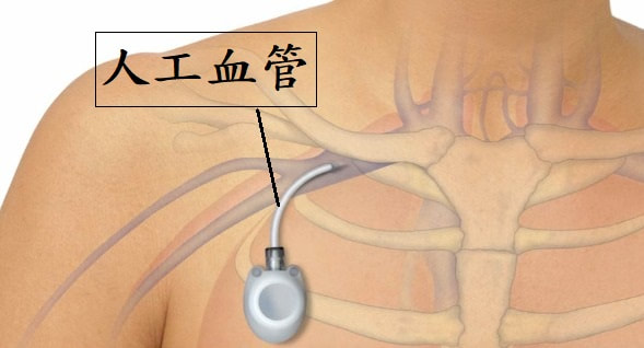 照片