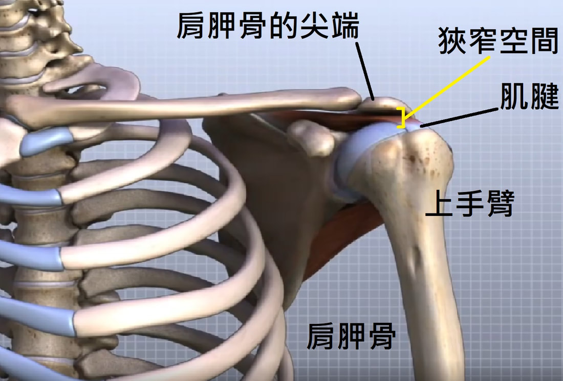 照片