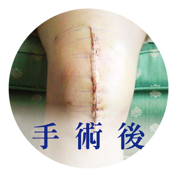 術後 見證